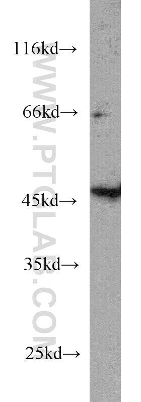 Western Blot (WB) analysis of HeLa cells using GALK2 Polyclonal antibody (15164-1-AP)