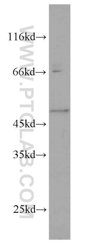 Western Blot (WB) analysis of HEK-293 cells using GALK2 Polyclonal antibody (15164-1-AP)