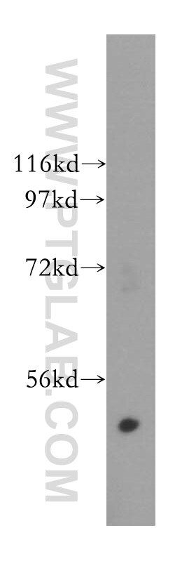 Western Blot (WB) analysis of HeLa cells using GALK2 Polyclonal antibody (15164-1-AP)