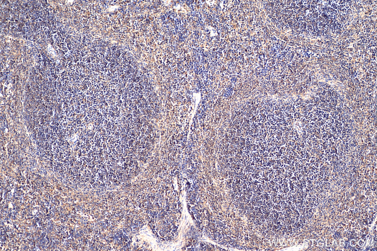 Immunohistochemistry (IHC) staining of mouse spleen tissue using GALM Polyclonal antibody (16022-1-AP)