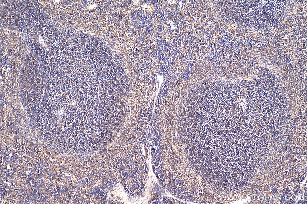 IHC staining of mouse spleen using 16022-1-AP