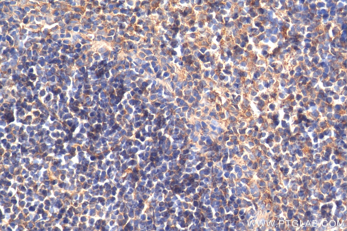 Immunohistochemistry (IHC) staining of mouse spleen tissue using GALM Polyclonal antibody (16022-1-AP)