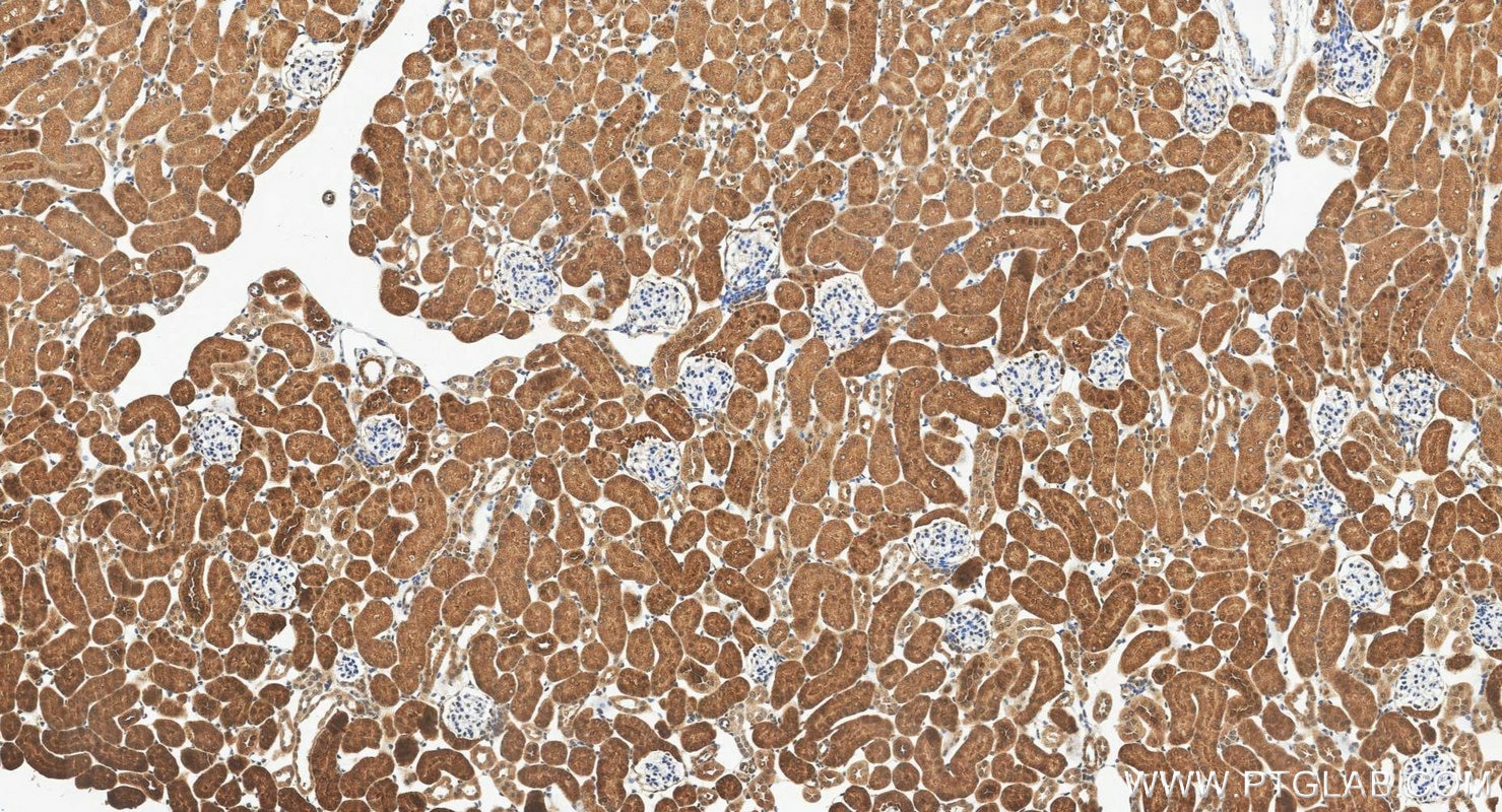 Immunohistochemistry (IHC) staining of mouse kidney tissue using GALM Polyclonal antibody (16022-1-AP)