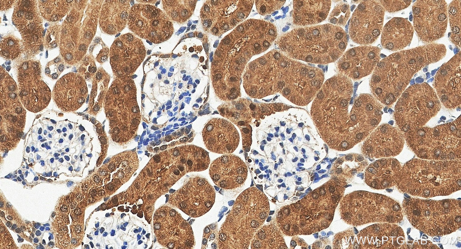 Immunohistochemistry (IHC) staining of mouse kidney tissue using GALM Polyclonal antibody (16022-1-AP)