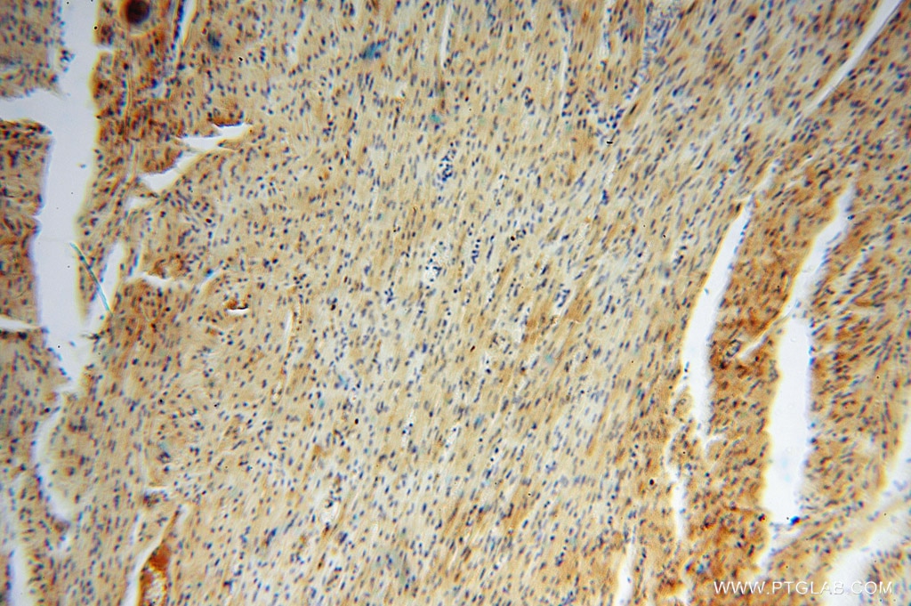 IHC staining of human heart using 16022-1-AP