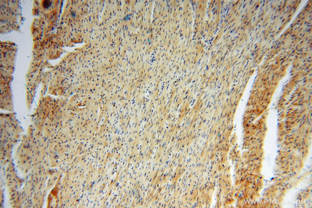 Immunohistochemistry (IHC) staining of human heart tissue using GALM Polyclonal antibody (16022-1-AP)