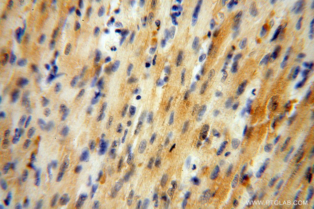 Immunohistochemistry (IHC) staining of human heart tissue using GALM Polyclonal antibody (16022-1-AP)