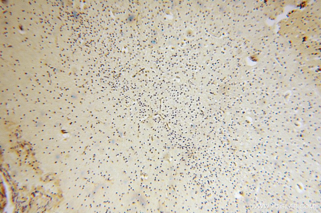 Immunohistochemistry (IHC) staining of human brain tissue using GALM Polyclonal antibody (16022-1-AP)