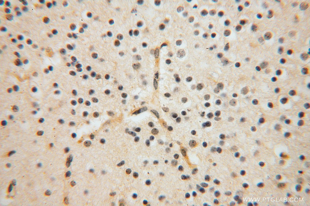 Immunohistochemistry (IHC) staining of human brain tissue using GALM Polyclonal antibody (16022-1-AP)