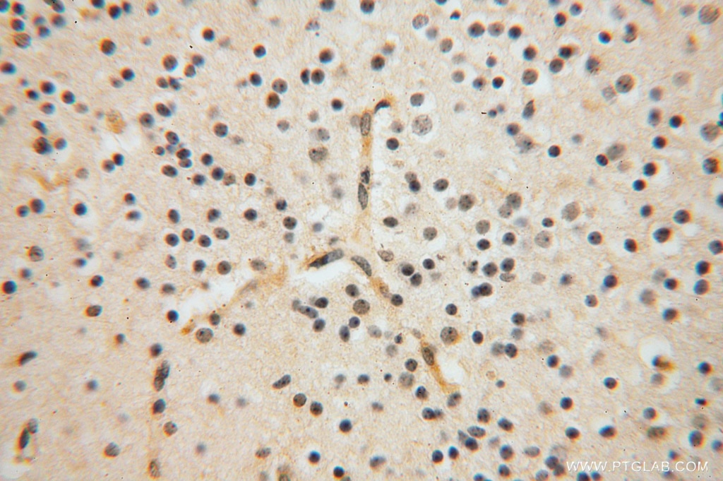 IHC staining of human brain using 16022-1-AP