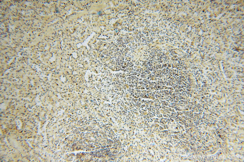 Immunohistochemistry (IHC) staining of human spleen tissue using GALM Polyclonal antibody (16022-1-AP)