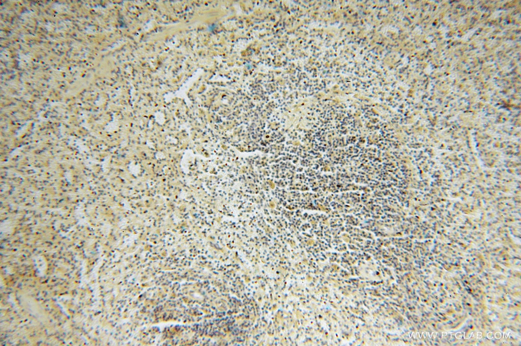 IHC staining of human spleen using 16022-1-AP