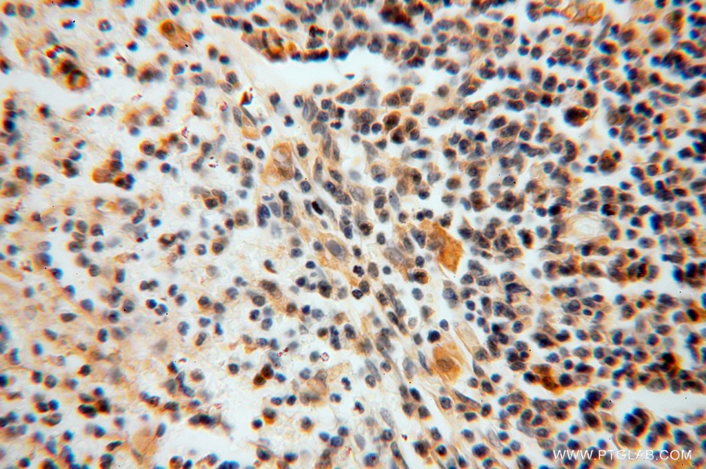 Immunohistochemistry (IHC) staining of human spleen tissue using GALM Polyclonal antibody (16022-1-AP)