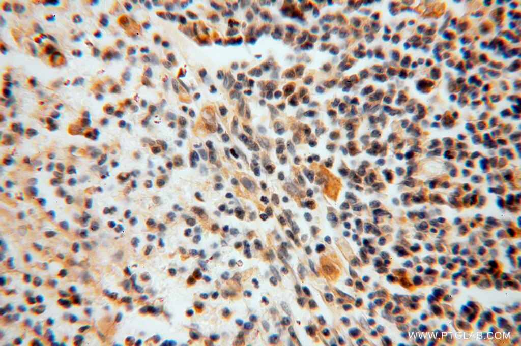 IHC staining of human spleen using 16022-1-AP