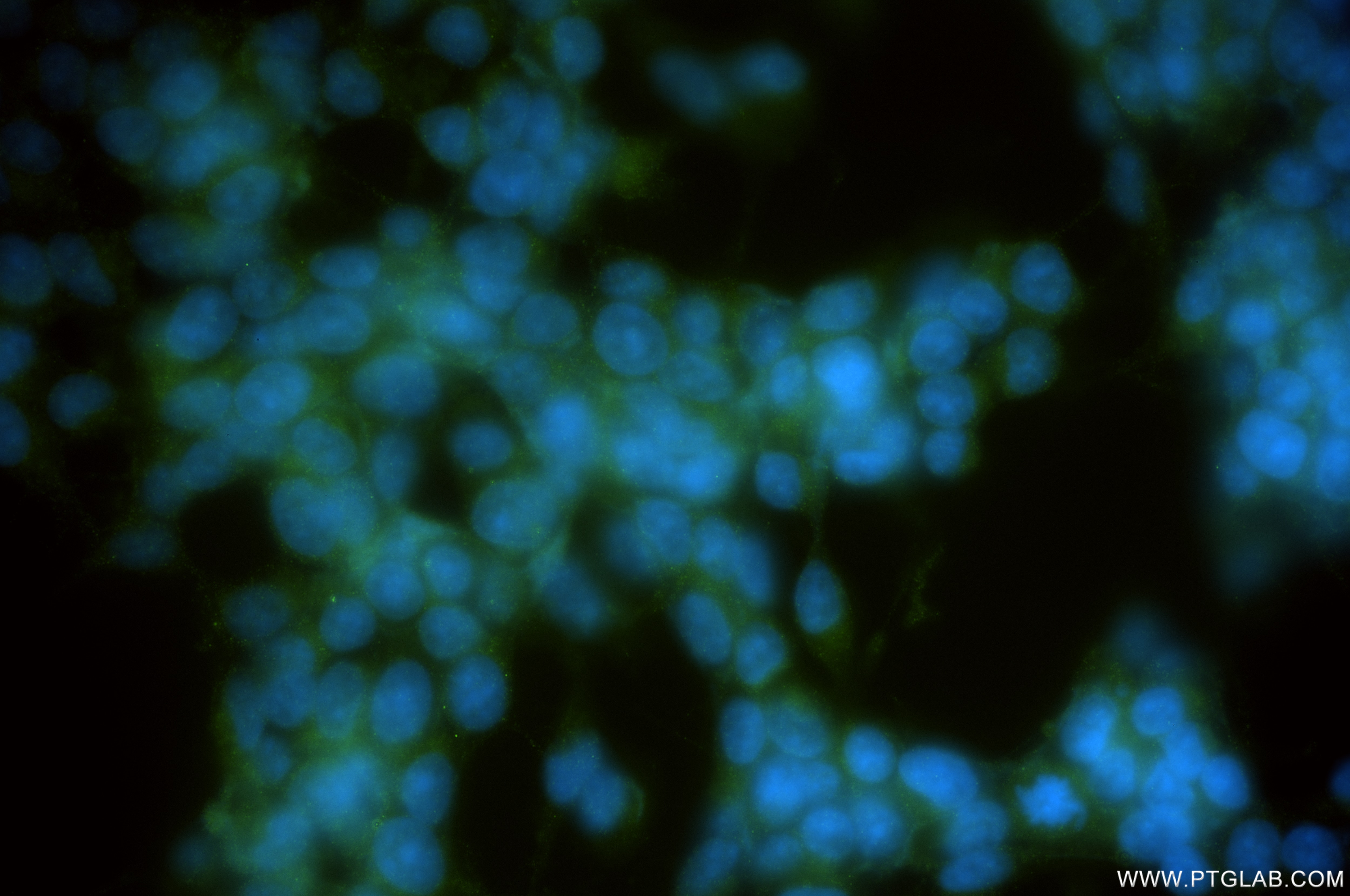 Immunofluorescence (IF) / fluorescent staining of SH-SY5Y cells using GALM Recombinant antibody (86369-1-RR)