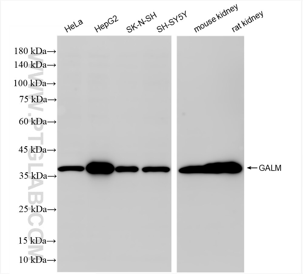 Western Blot (WB) analysis of various lysates using GALM Recombinant antibody (86369-1-RR)