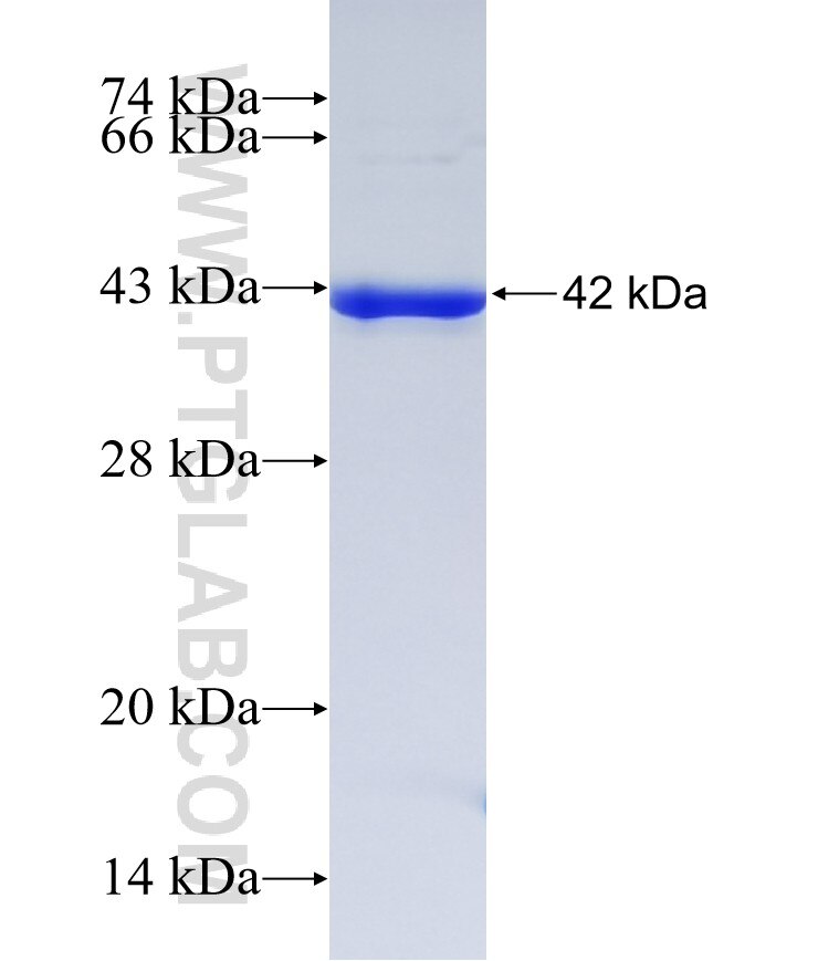 GALM fusion protein Ag8842 SDS-PAGE