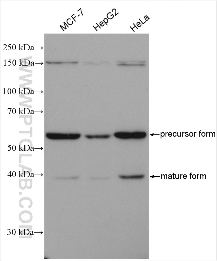 Western Blot (WB) analysis of various lysates using GALNS Polyclonal antibody (14933-1-AP)