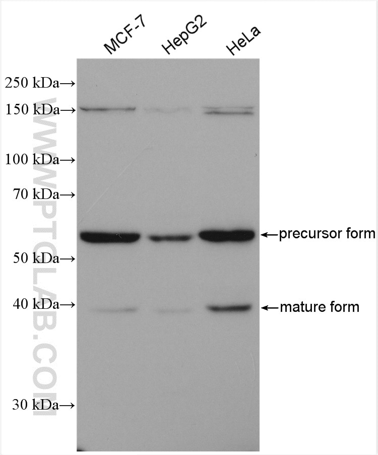 Western Blot (WB) analysis of various lysates using GALNS Polyclonal antibody (14933-1-AP)