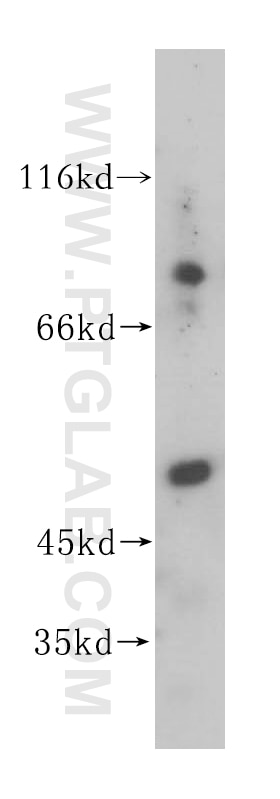 Western Blot (WB) analysis of human liver tissue using GALNS Polyclonal antibody (14933-1-AP)