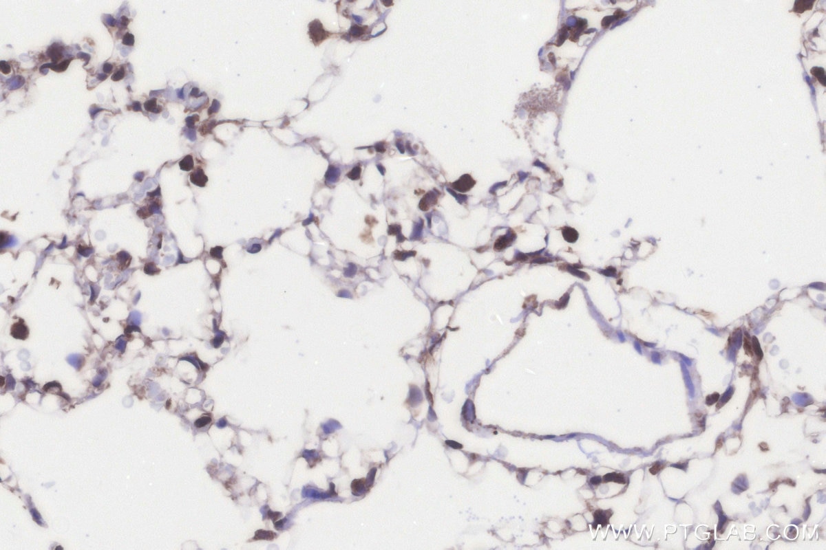 IHC staining of rat lung using 21139-1-AP (same clone as 21139-1-PBS) Immunohistochemistry (IHC) staining of rat lung tissue using GALNT1 Polyclonal antibody (21139-1-AP)