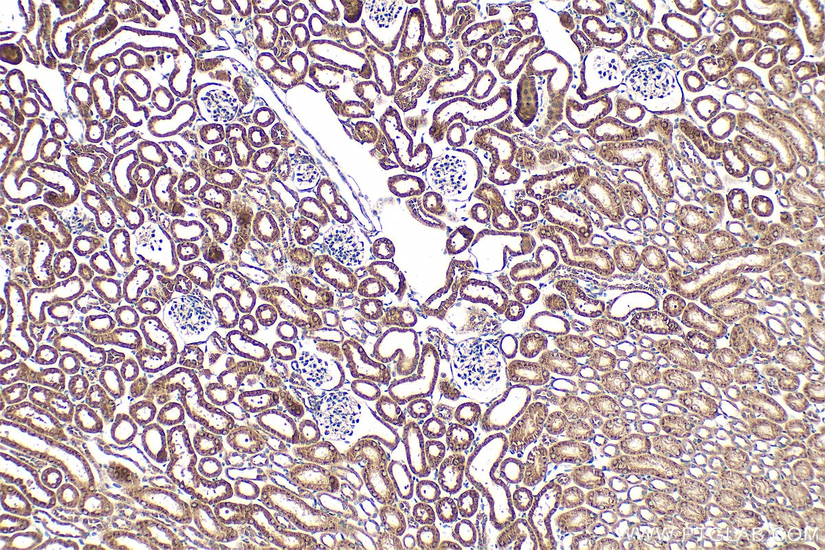 IHC staining of mouse kidney using 21139-1-AP (same clone as 21139-1-PBS) Immunohistochemistry (IHC) staining of mouse kidney tissue using GALNT1 Polyclonal antibody (21139-1-AP)