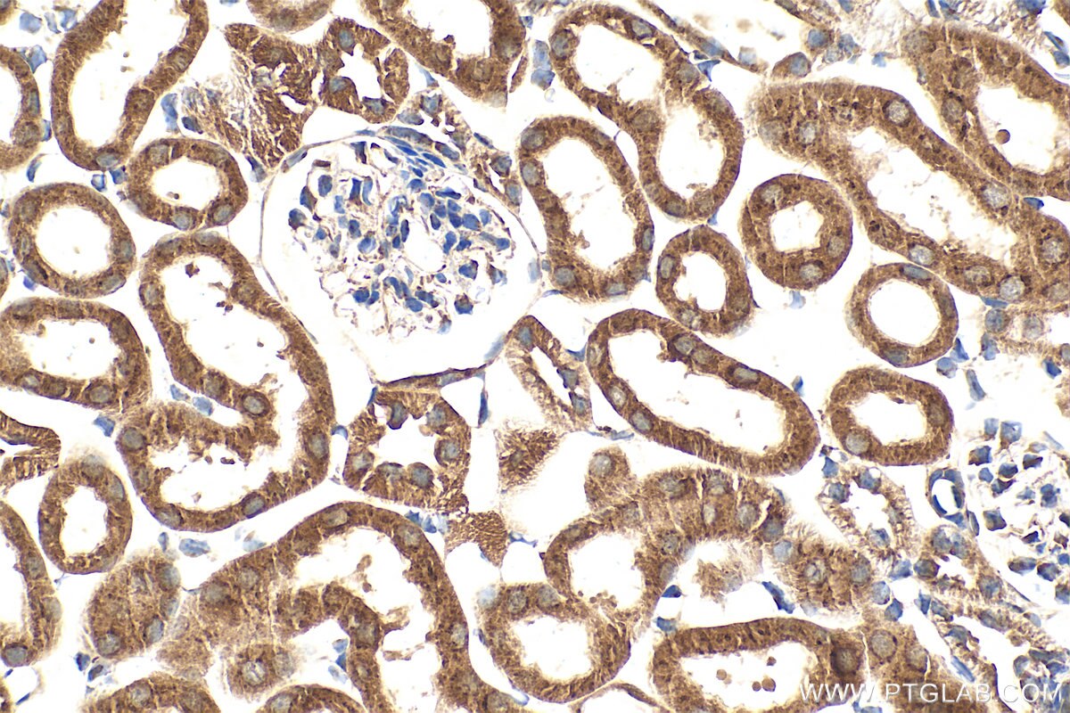 IHC staining of mouse kidney using 21139-1-AP (same clone as 21139-1-PBS) Immunohistochemistry (IHC) staining of mouse kidney tissue using GALNT1 Polyclonal antibody (21139-1-AP)
