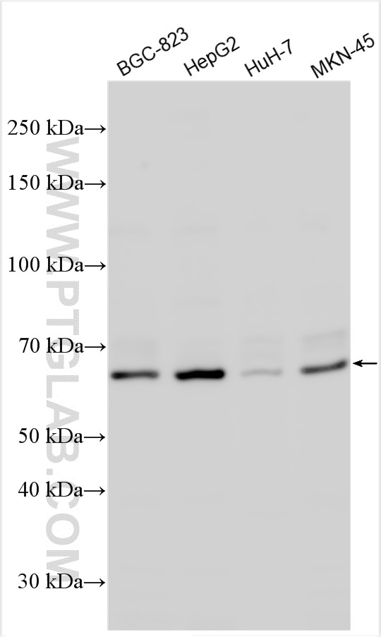 Western Blot (WB) analysis of various lysates using GALNT1 Polyclonal antibody (21139-1-AP)