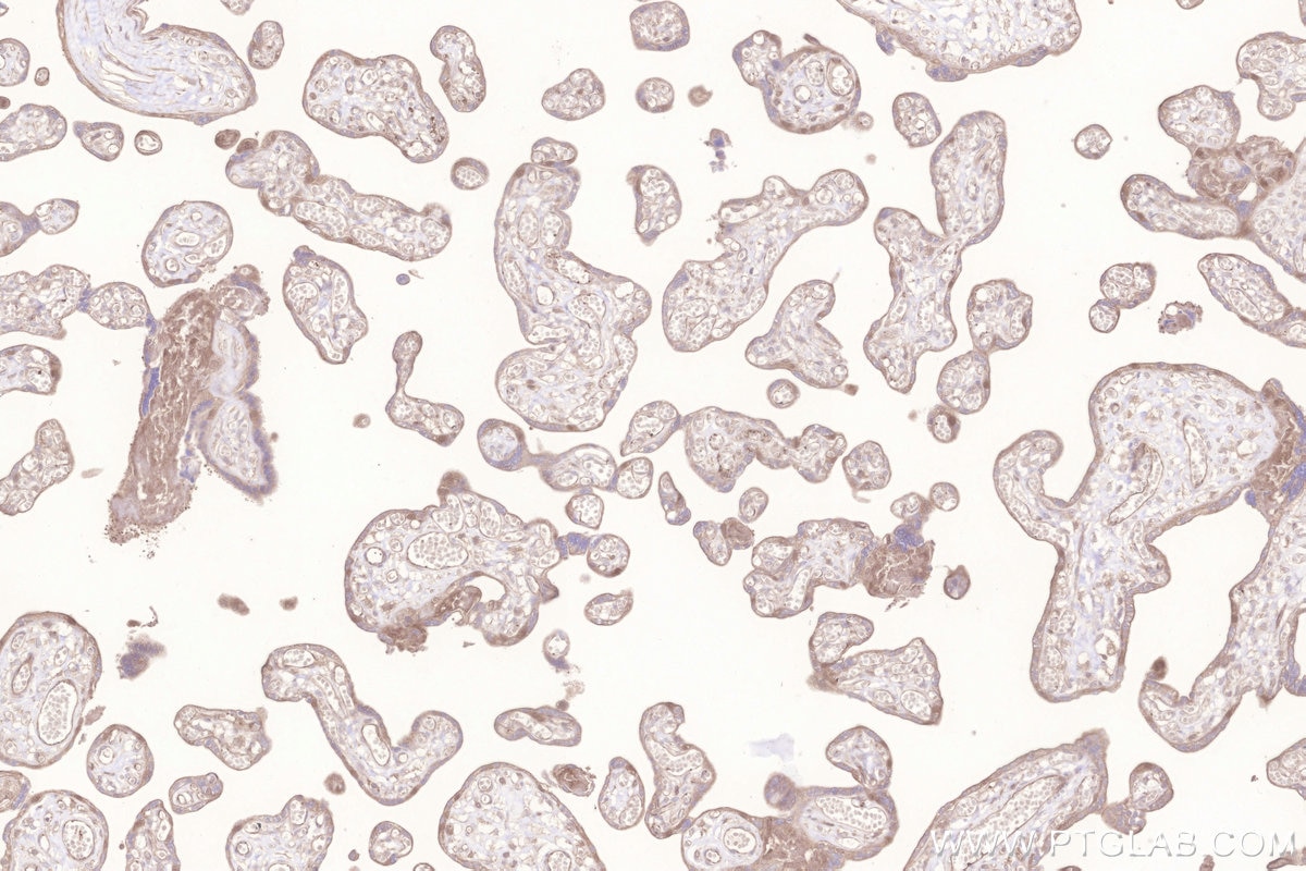 Immunohistochemistry (IHC) staining of human placenta tissue using GALNT10 Polyclonal antibody (20822-1-AP)