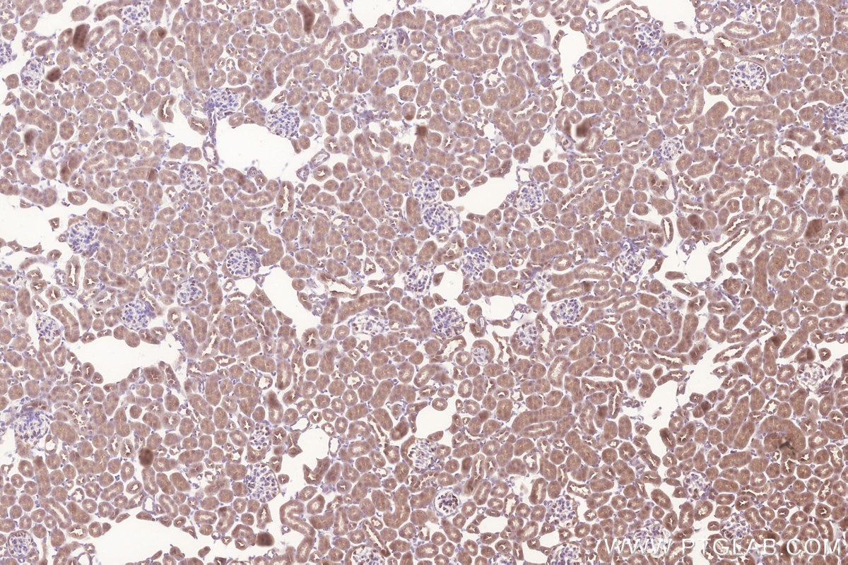 Immunohistochemistry (IHC) staining of mouse kidney tissue using GALNT10 Polyclonal antibody (20822-1-AP)