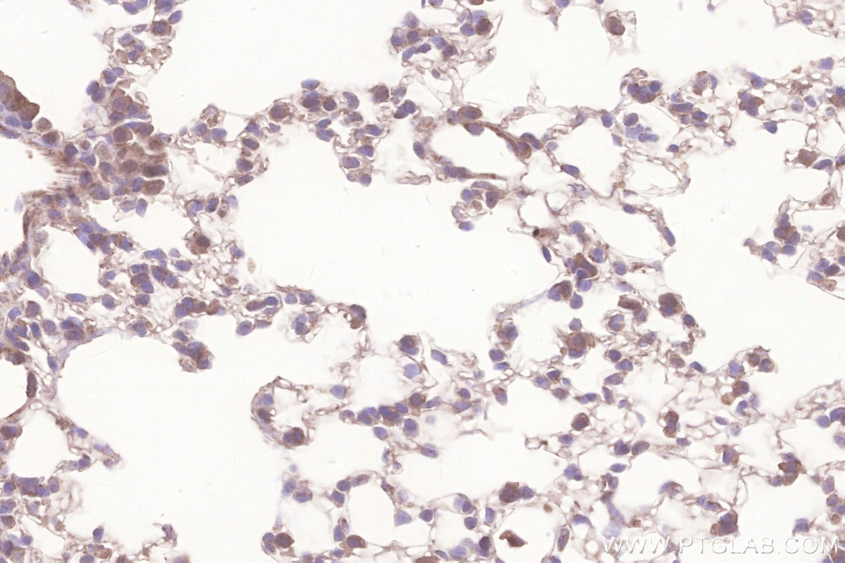 Immunohistochemistry (IHC) staining of mouse lung tissue using GALNT10 Polyclonal antibody (20822-1-AP)