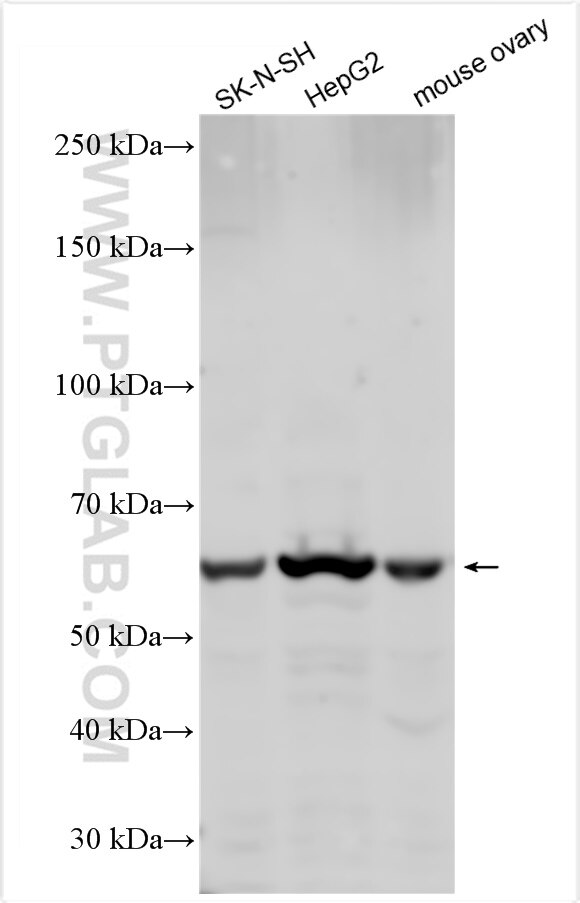Western Blot (WB) analysis of various lysates using GALNT10 Polyclonal antibody (20822-1-AP)