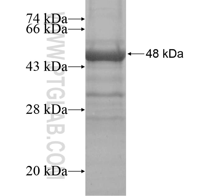 GALNT10 fusion protein Ag14751 SDS-PAGE