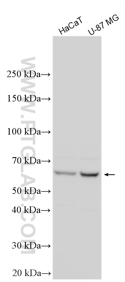 Western Blot (WB) analysis of various lysates using GALNT12 Polyclonal antibody (16415-1-AP)