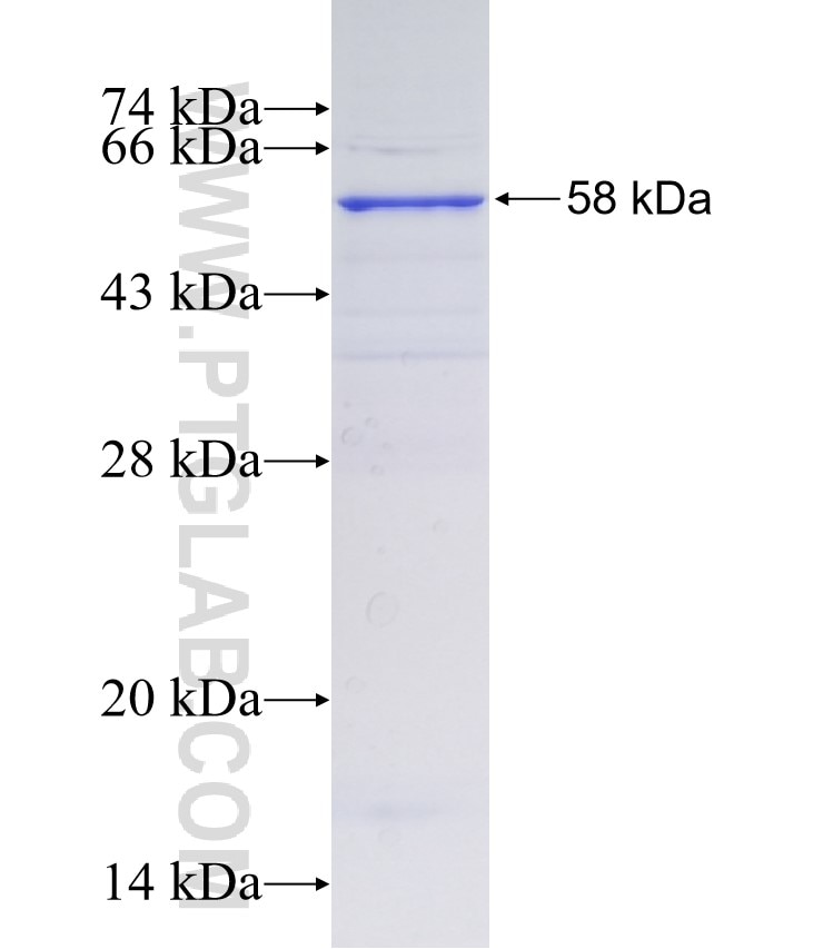 GALNT12 fusion protein Ag9571 SDS-PAGE