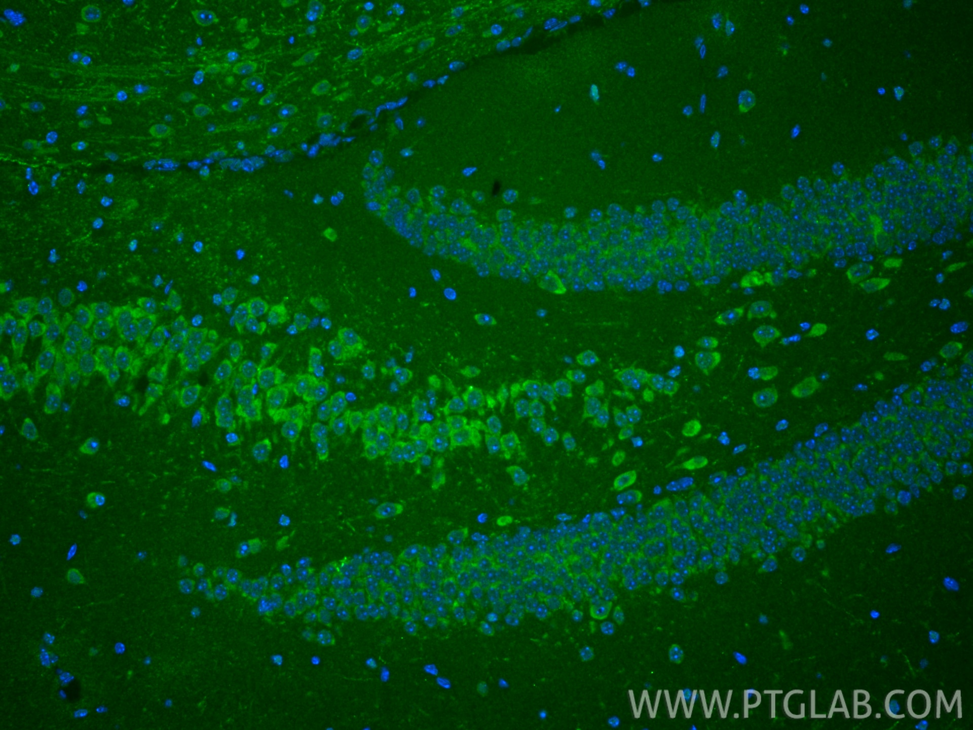 IF Staining of mouse brain using 24604-1-AP Immunofluorescence (IF) / fluorescent staining of mouse brain tissue using GALNT13 Polyclonal antibody (24604-1-AP)