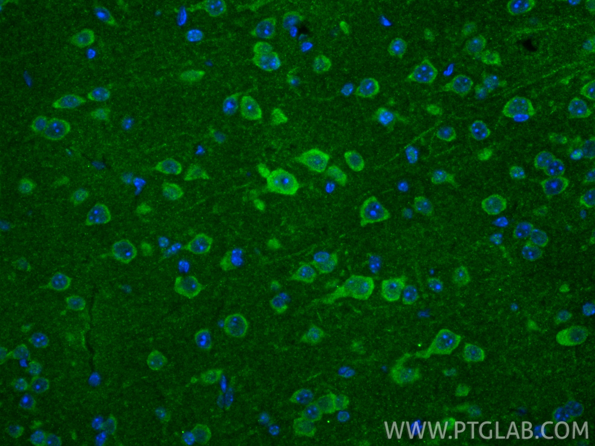 IF Staining of mouse brain using 24604-1-AP Immunofluorescence (IF) / fluorescent staining of mouse brain tissue using GALNT13 Polyclonal antibody (24604-1-AP)