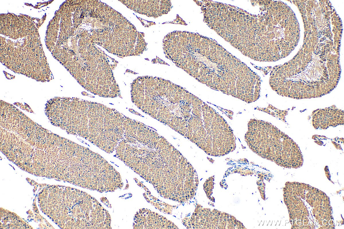 Immunohistochemical analysis of paraffin-embedded mouse testis tissue slide using 24604-1-AP (GALNT13 antibody) at dilution of 1:200 (under 10x lens). Heat mediated antigen retrieval with Tris-EDTA buffer (pH 9.0). Immunohistochemistry (IHC) staining of mouse testis tissue using GALNT13 Polyclonal antibody (24604-1-AP)