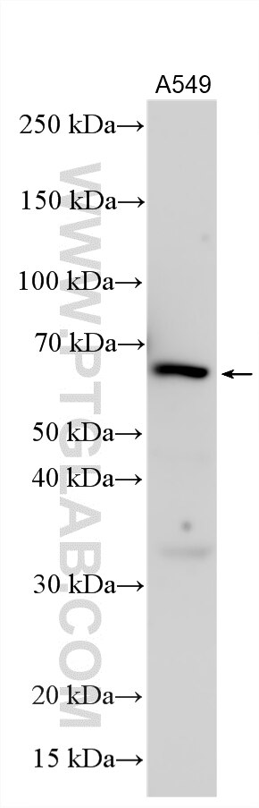 Western Blot (WB) analysis of various lysates using GALNT13 Polyclonal antibody (24604-1-AP)