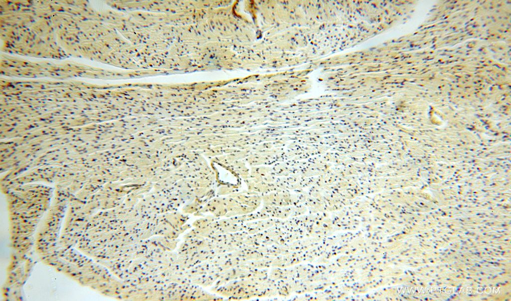 Immunohistochemistry (IHC) staining of human heart tissue using GALNT14 Polyclonal antibody (16939-1-AP)