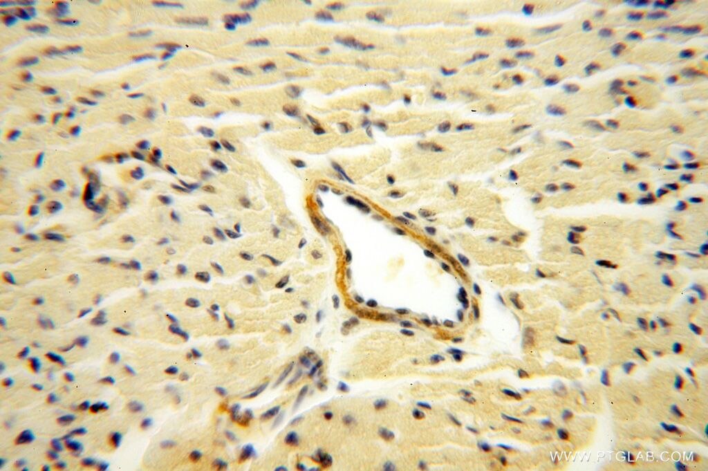 Immunohistochemistry (IHC) staining of human heart tissue using GALNT14 Polyclonal antibody (16939-1-AP)