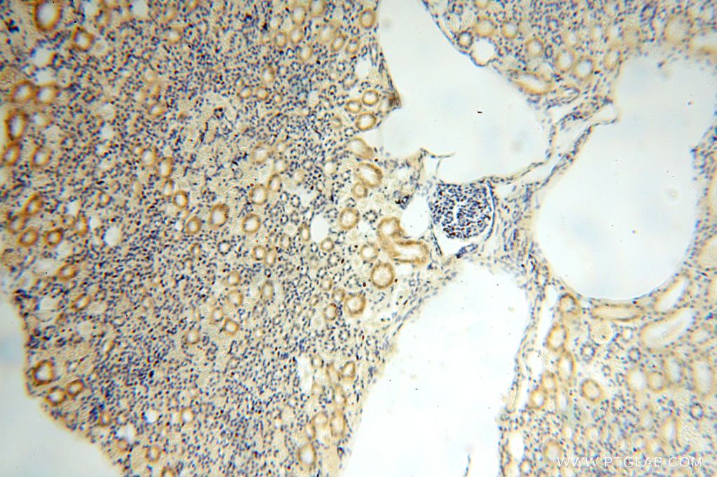 Immunohistochemistry (IHC) staining of human kidney tissue using GALNT14 Polyclonal antibody (16939-1-AP)