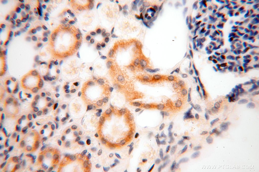 Immunohistochemistry (IHC) staining of human kidney tissue using GALNT14 Polyclonal antibody (16939-1-AP)