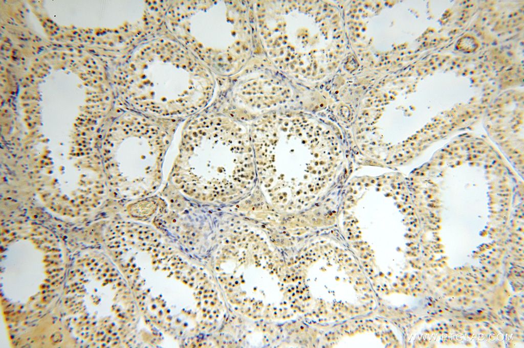Immunohistochemistry (IHC) staining of human testis tissue using GALNT14 Polyclonal antibody (16939-1-AP)