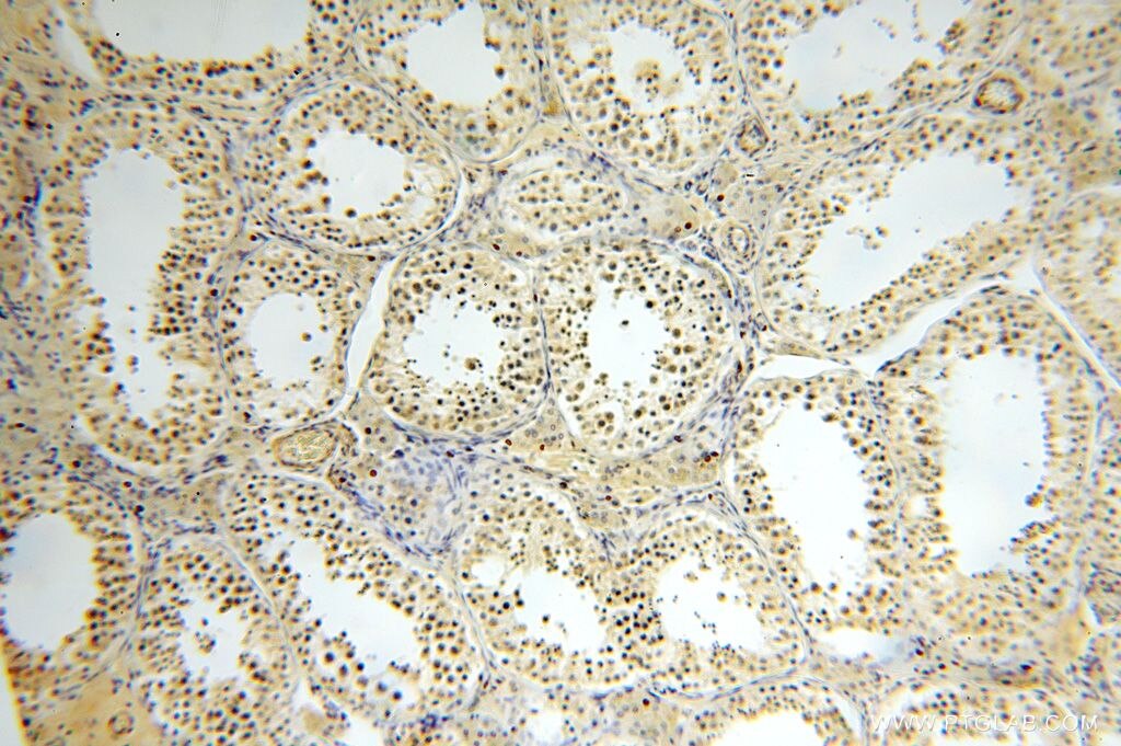 IHC staining of human testis using 16939-1-AP