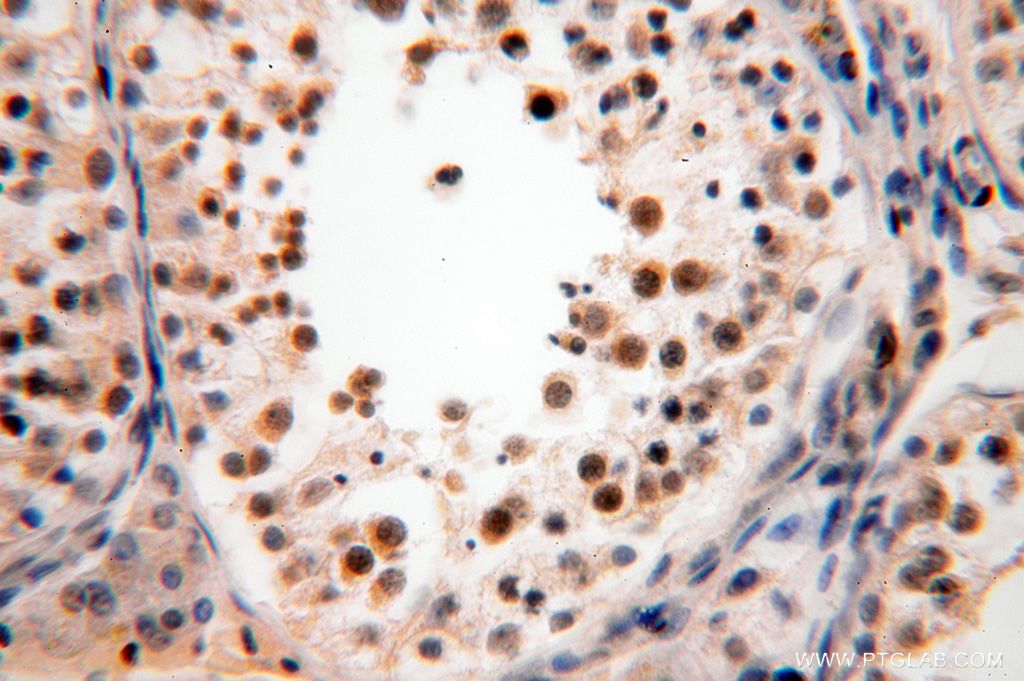 Immunohistochemistry (IHC) staining of human testis tissue using GALNT14 Polyclonal antibody (16939-1-AP)