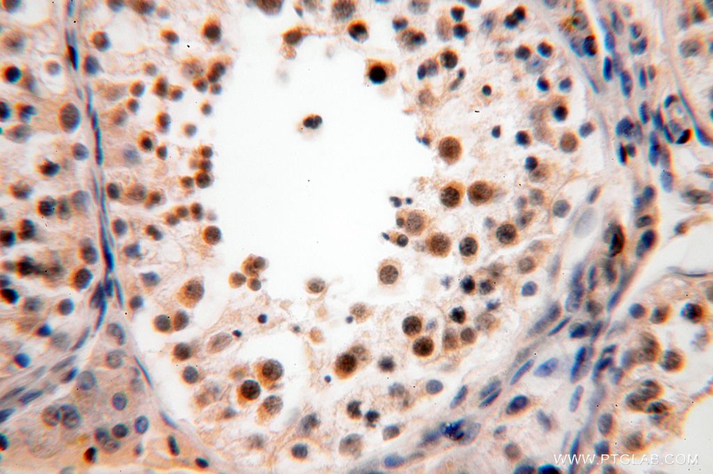 IHC staining of human testis using 16939-1-AP