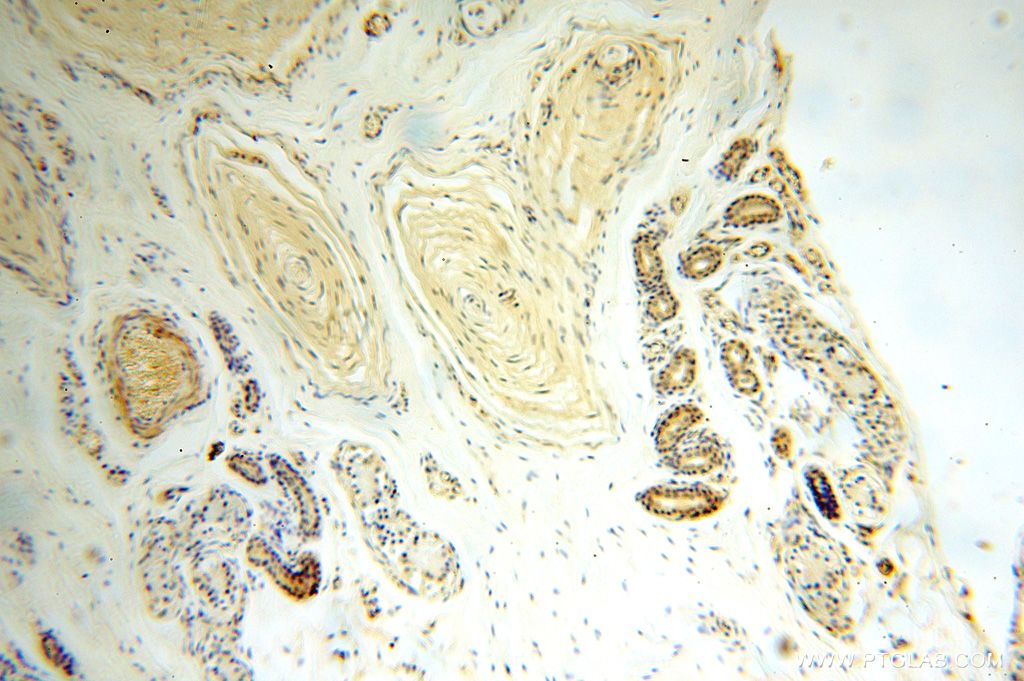 Immunohistochemistry (IHC) staining of human skin tissue using GALNT14 Polyclonal antibody (16939-1-AP)