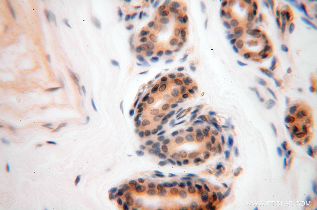 Immunohistochemistry (IHC) staining of human skin tissue using GALNT14 Polyclonal antibody (16939-1-AP)