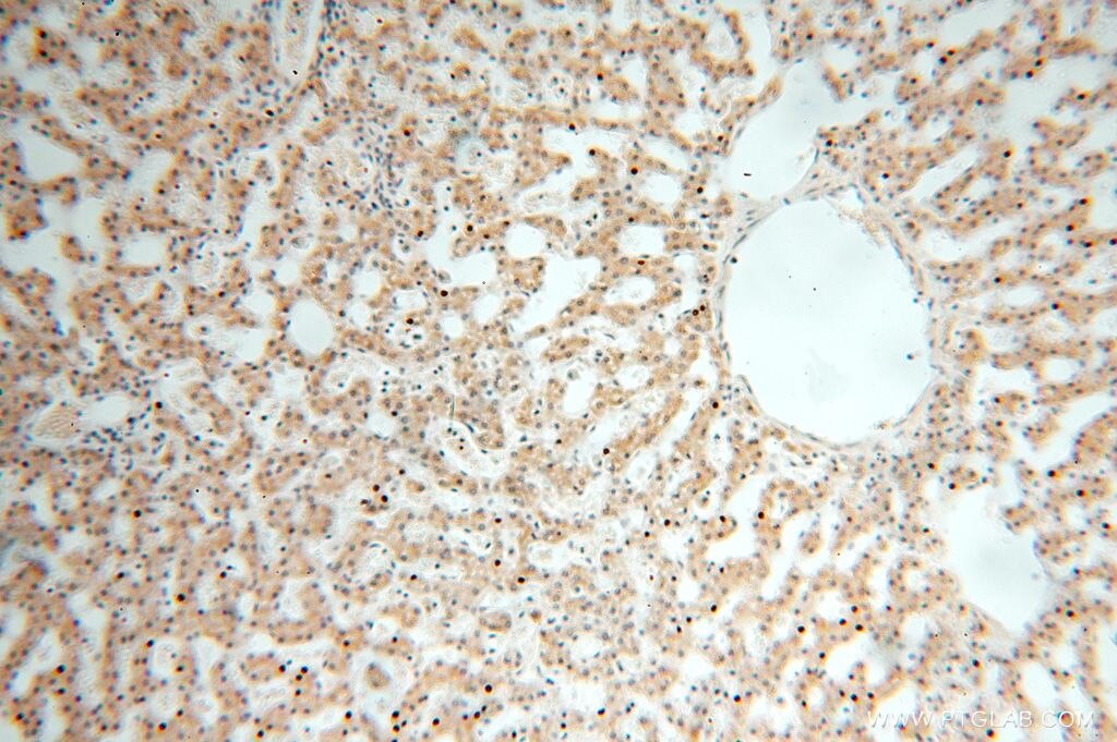Immunohistochemistry (IHC) staining of human liver tissue using GALNT14 Polyclonal antibody (16939-1-AP)